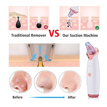 Electric Facial Blackhead Remover Vacuum Pore Cleaner Acne Cleanser Black Spots Removal Face Nose Deep Cleaning Tools Dropship